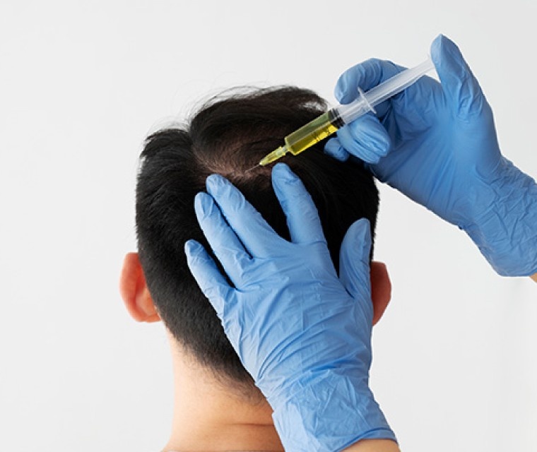 Hair_PRP-GFC