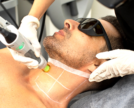 best_laser_hair_removal_in_varanasi